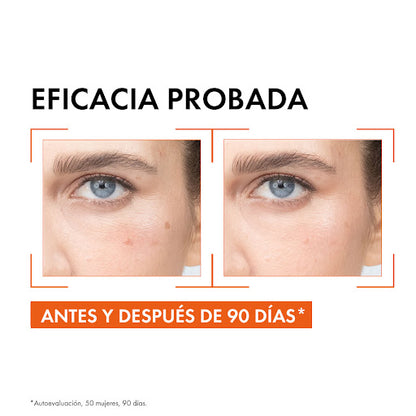 LIFTACTIV SUPREME VITAMIN C SERUM 20ML